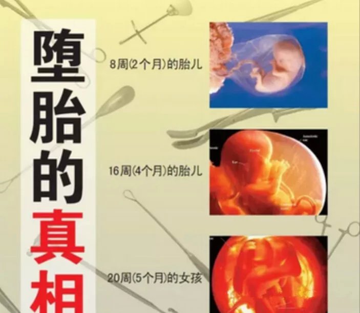 堕胎后婴灵如何报复父母--转发等于救命积福报